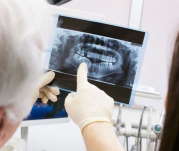 dental X Ray in Bandra West