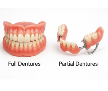 Full Dentures treatment in Bandra West