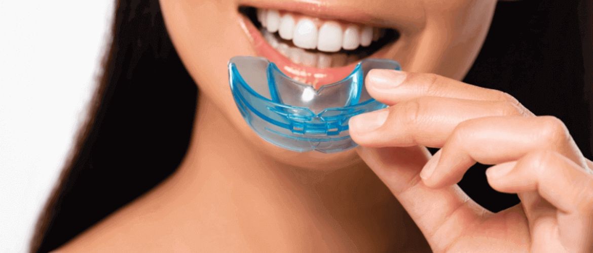mouthguards in Bandra West