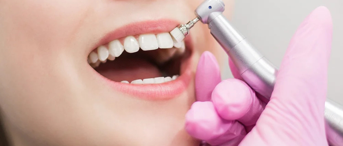 Teeth Cleaning in Bandra West