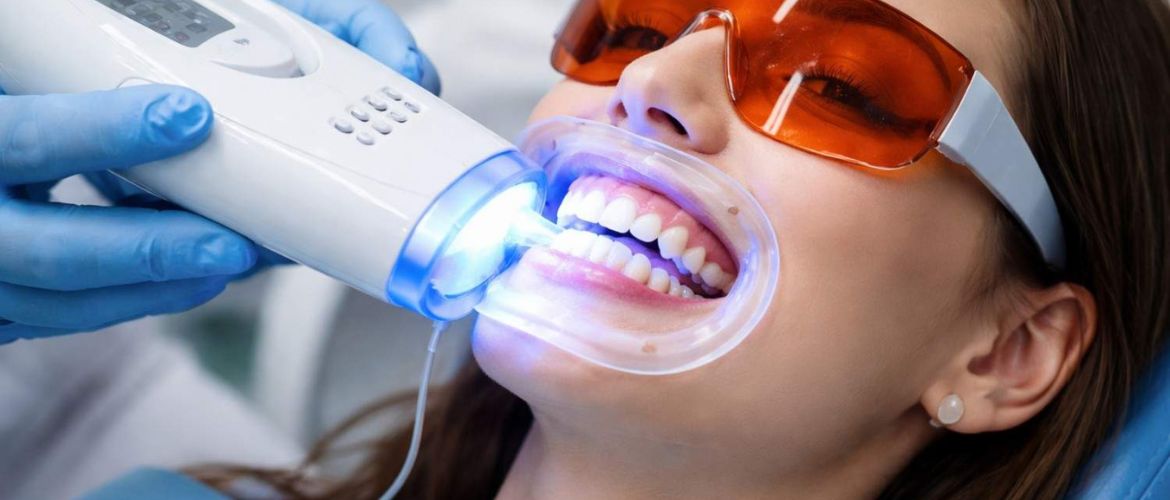 teeth-whitening treatment in Bandra West
